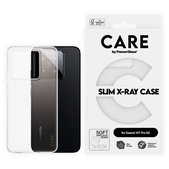 Tok X-Ray - Xiaomi 15T Pro 5G, átlátszó, CARE